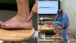 Tratamiento de la tendinitis de los peroneos  Fisioterapia Bilbao [upl. by Pendergast]