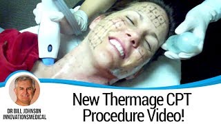 New Thermage CPT Procedure Video  Dr Bill Johnson [upl. by Eltsirhc]