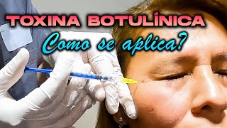 CURSO de TOXINA BOTULINICA  BOTOX ✅ 🔴Como se aplica QUE CUIDADOS 🤔 [upl. by Pfaff566]