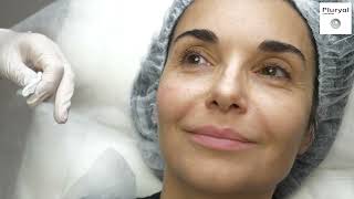 Attractive face with Pluryal Creating natural volume and increasing skin density [upl. by Eniamej]