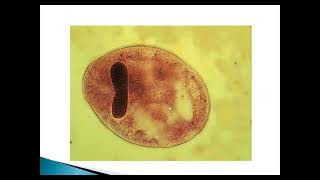 Blastocystis spp y Balantidium colo Balantioides coli [upl. by Leiria270]