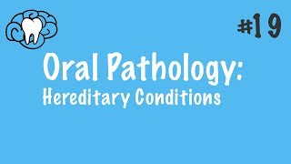 Oral Pathology  Hereditary Conditions  INBDE ADAT [upl. by Albertina]