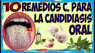 10 Remedios Caseros para la Candidiasis Oral – Como Combatir la Cándida en la Boca [upl. by Orelee]