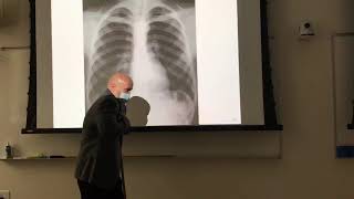 Chest xray positioning [upl. by Rea]