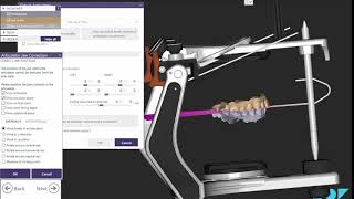 How to Align an Articulator in EXOCAD [upl. by Ahearn]