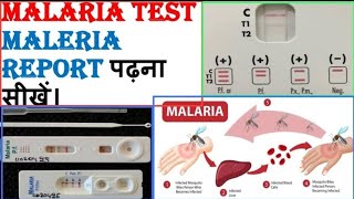 मलेरिया रिपोर्ट की जांच कैसे करें  Malaria Test Report  Malaria Symptoms  Malaria Treatment [upl. by Llen]