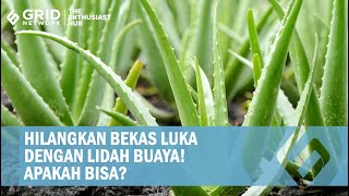 Lidah Buaya Bisa Menghilangkan Bekas Luka Gini Cara Pakai Bahan Alami [upl. by Neillij]