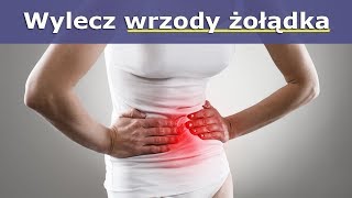 Wylecz wrzody żołądka bez leków  skutecznie [upl. by Sleinad]