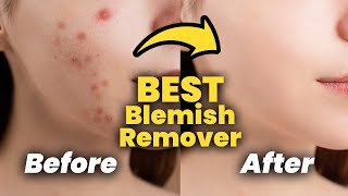 2024 How to Remove Blemishes from Photos  Photo Blemish Remover APP [upl. by Ecinereb]