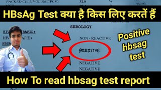 Hbsag Positive  hbsag test  hbsag test in hindi  hbsag test report  hepatitis b test results [upl. by Karlens]