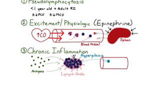 Lymphocytosis [upl. by Yruam]