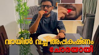 വായിൽ വച്ച അപ്പകഷ്ണം ചോരയായി  Tricks Episode  298 [upl. by Kilroy]