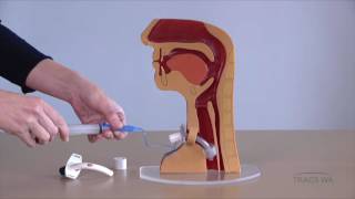 Tracheostomy  Respiratory phonatory and swallowing function  TRACS WA [upl. by Ecadnac]