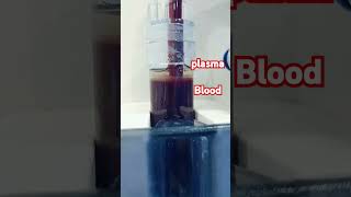 live plasma during dialysis lifeofwayrizwan [upl. by Mcloughlin]