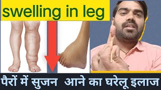 Swollen Legs with Acupressure  पैरों में सुजन आने इलाज  drDkpatel [upl. by Leibarg]