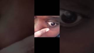 104 sec video eye mucus fishing syndrome 4142024 [upl. by Nojel]