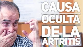 Episodio 1385 Causa Oculta De La Artritis [upl. by Thorwald247]