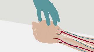 How to perform an arterial puncture PL – Radiometer [upl. by Erica909]