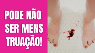 🔴MENSTRUAÇÃO OU SANGRAMENTO VAGINAL  VOCÊ SABE A DIFERENÇA  DRA NEIDE PIRES [upl. by Ettecul]