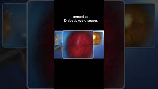 Can I have Glaucoma from diabetes？ [upl. by Glovsky]