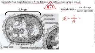 Calculating Magnification IB Biology [upl. by Aicilf]