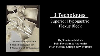 Superior Hypogastric Plexus Block 3 Techniques [upl. by Asiul]