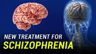 New Treatment for Schizophrenia [upl. by Yleen679]