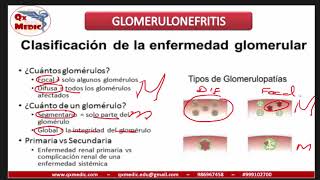 Qx nefrologia  GLOMERULONEFRITIS [upl. by Acyssej]