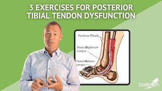 3 Exercises for Posterior Tibial Tendon Dysfunction [upl. by Wilson28]