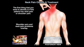 Neck Pain Causes and Treatment  Everything You Need To Know  Dr Nabil Ebraheim [upl. by Yauqaj282]