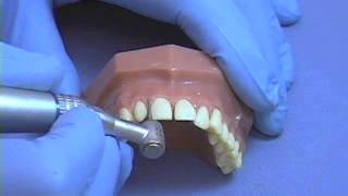 IMPROVED DENTAL HANDPIECE POSITION [upl. by Deedahs]