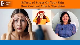 4 Ways how Stress affects the SkinToo HIGH Cortisol amp effects on skinDrAmee DaxiniDoctorsCircle [upl. by Baynebridge204]