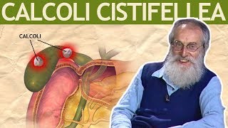 Dott Mozzi Calcoli alla cistifellea biliari colecisti [upl. by Sateia271]