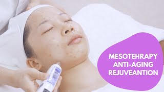 Mesotherapy  How To Do Mesotherapy  Needless Mesotherapy  No Needle Mesotherapy  myChway W1021 [upl. by Aliekahs870]