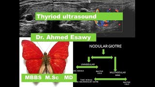 Thyroid ultrasound Imaging DrAhmed Esawy [upl. by Kempe932]