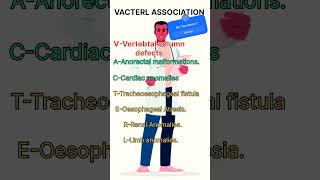 VACTERL ASSOCIATION [upl. by Cedric]