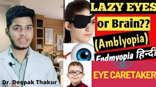 Amblyopia lazy eye  amblyopia treatment  one eye patient  patch therapy for lazy eye [upl. by Nayrbo]