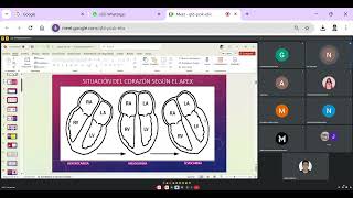 CLASE 9 Cardiopatias Congenitas y gandes vasos [upl. by Eirojram]