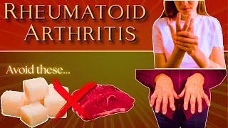 Rheumatoid Arthritis Foods to Avoid amp Foods to Embrace rheumatoidarthritis rheumatoidarthritis [upl. by Sirap]