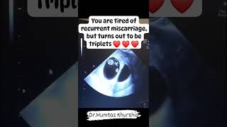 Triplets Pregnancy Ultrasound Scan [upl. by Matilda659]