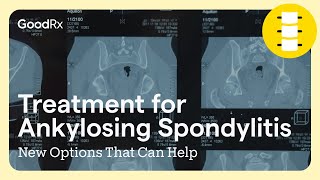 Treatment for Ankylosing Spondylitis New Options That Can Help  GoodRx [upl. by Aikaj]