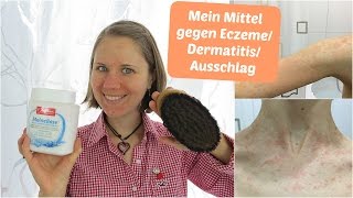 Mein Mittel gegen Hautprobleme Ekzeme Dermatitis Ausschlag etc [upl. by Cyril]