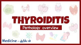 Thyroiditis non neoplastic thyroid enlargement hashimoto thyroiditis De Quervain thyroiditis [upl. by Ric399]