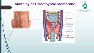 Cricothyroidotomy [upl. by Irpac]