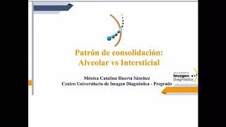 Patrón de consolidación alveolar vs intersticial [upl. by Beitnes]