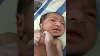 Medical Education Video Neonatology Lip smacking movements Subtle seizures [upl. by Averyl]