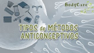 Tipos de métodos anticonceptivos [upl. by Jehoash]