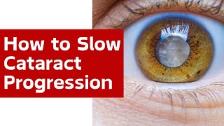 How to Slow Cataract Progression  How to Prevent Cataract  सफ़ेद मोतियाबिंद  Dr Nalini Saxena [upl. by Yelsehc701]