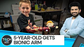 Meet the youngest person to receive a bionic arm  Tech It Out [upl. by Killoran]