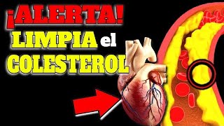 LIMPIÁ tus ARTERIAS de COLESTEROL sin MEDICACION Los MEJORES ALIMENTOS para MEJORAR el COLESTEROL [upl. by Keon]